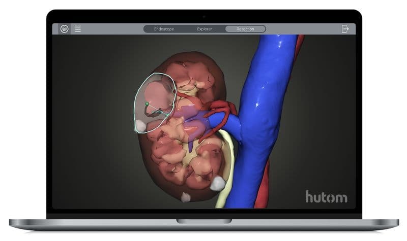Virtual Resection Simulation hutom